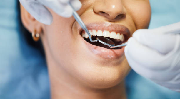 Best Dental Abscess Treatment in Homer, GA